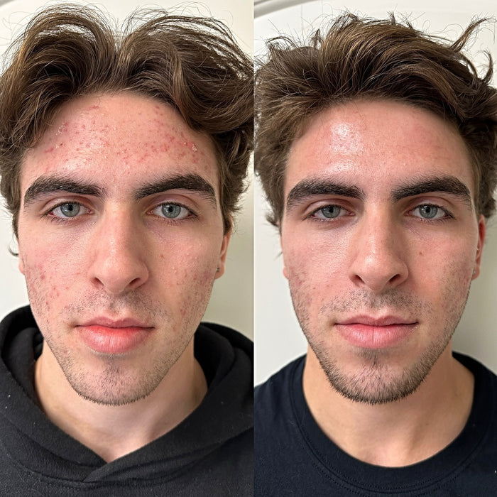 Jason Martinez, Chicago