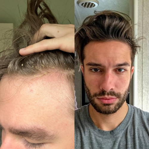 Steve Johnson, Phoenix